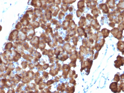 Formalin-fixed, paraffin embedded rat pancreas sections stained with 100 ul anti-Ornithine Decarboxylase-1 (clone ODC1/486) at 1:50. HIER epitope retrieval prior to staining was performed in 10mM Citrate, pH 6.0.